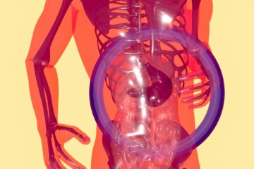 The Cost of Scoliosis Surgery: What You Need to Know